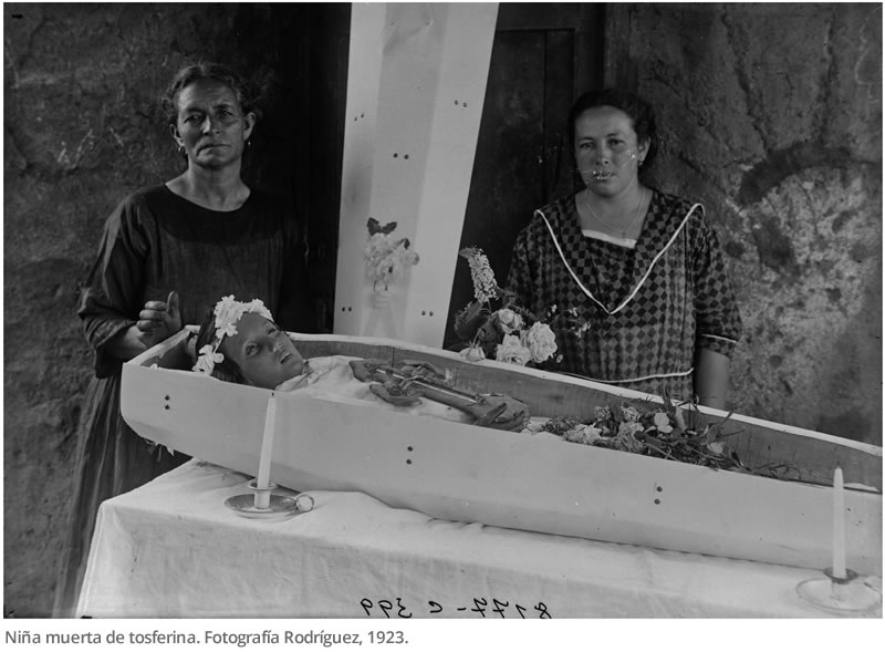 Niña muerta de tosferina. Fotografía Rodríguez, 1923.